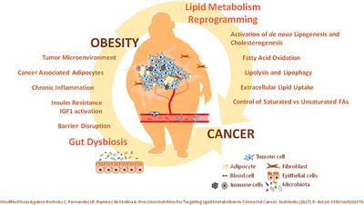 Alterations of Lipid Metabolism in Cancer: Implications in Prognosis and Treatment